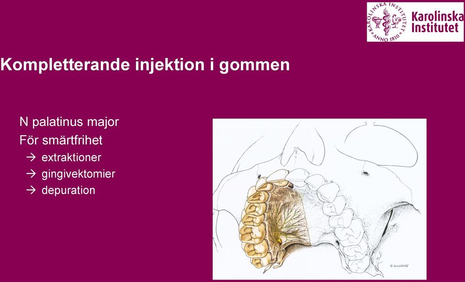 För smärtfrihet