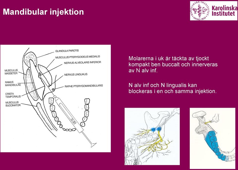 ben buccalt och innerveras av N alv inf.