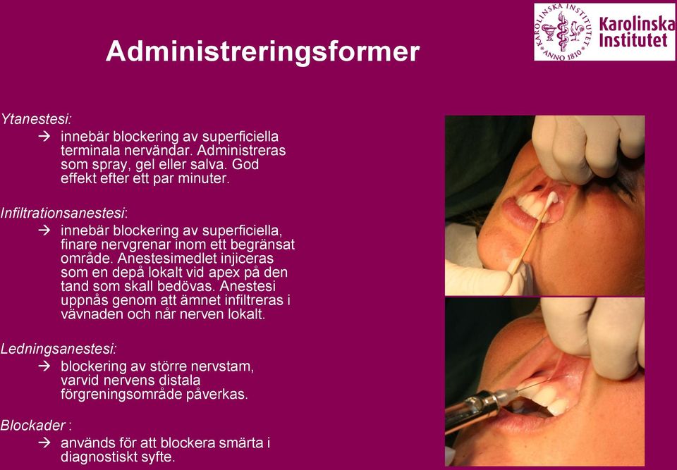 Anestesimedlet injiceras som en depå lokalt vid apex på den tand som skall bedövas.