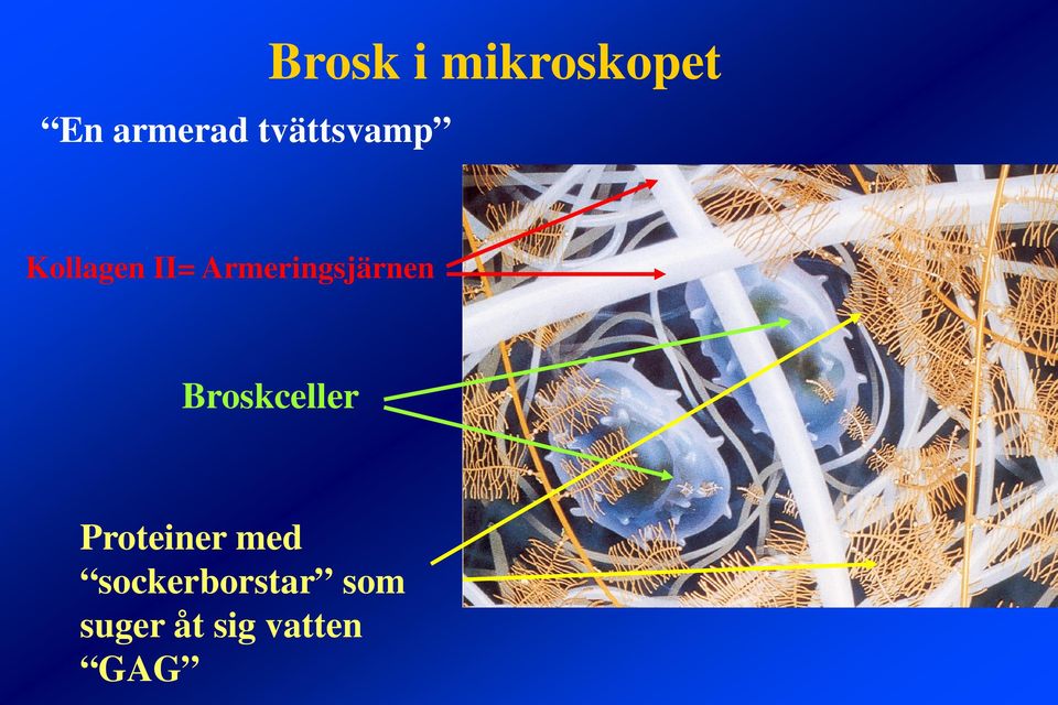 Armeringsjärnen Broskceller