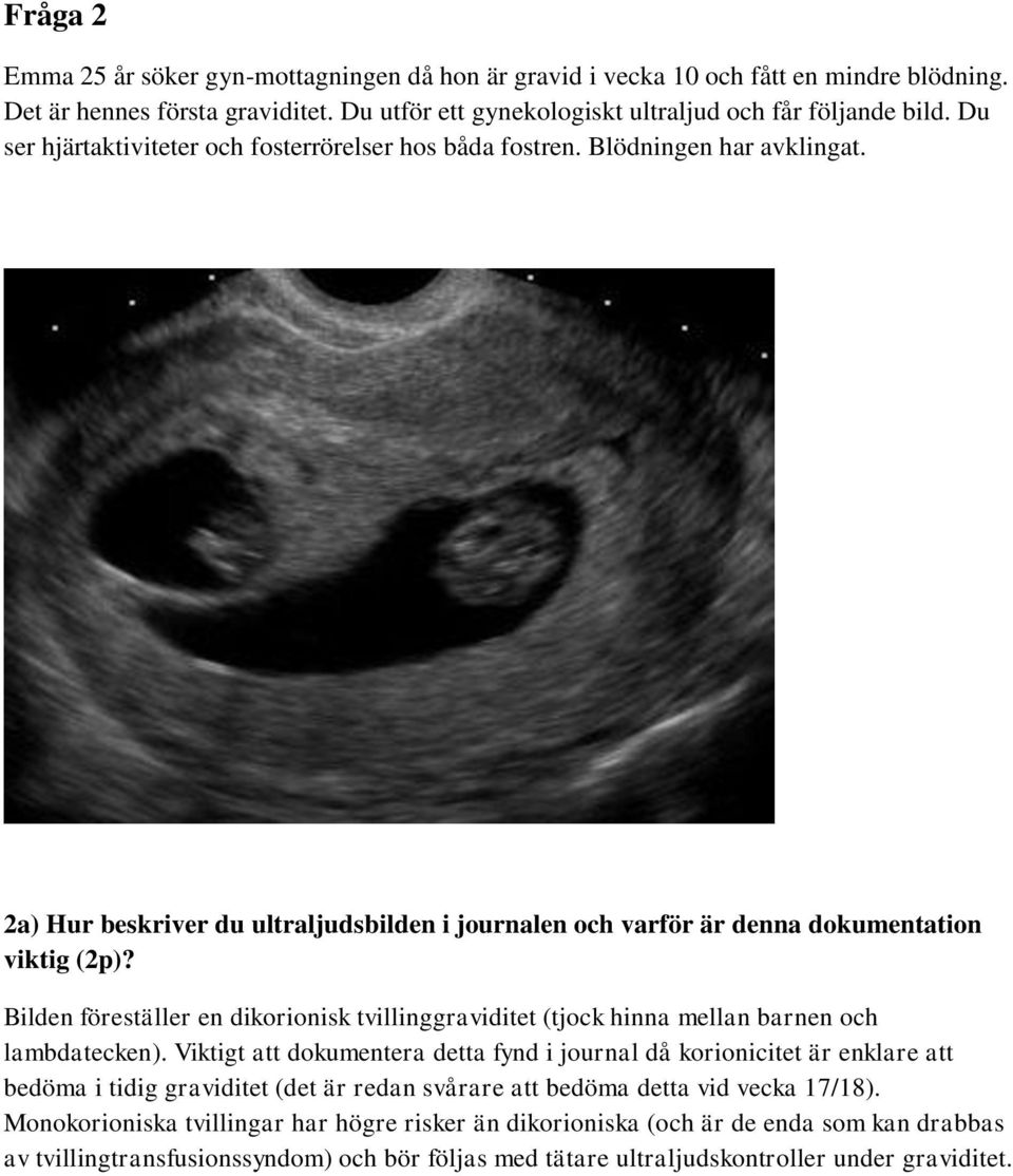 Bilden föreställer en dikorionisk tvillinggraviditet (tjock hinna mellan barnen och lambdatecken).