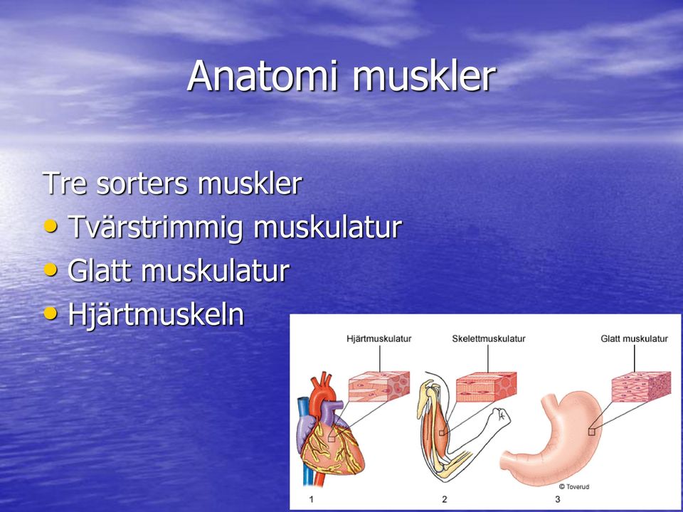 Tvärstrimmig