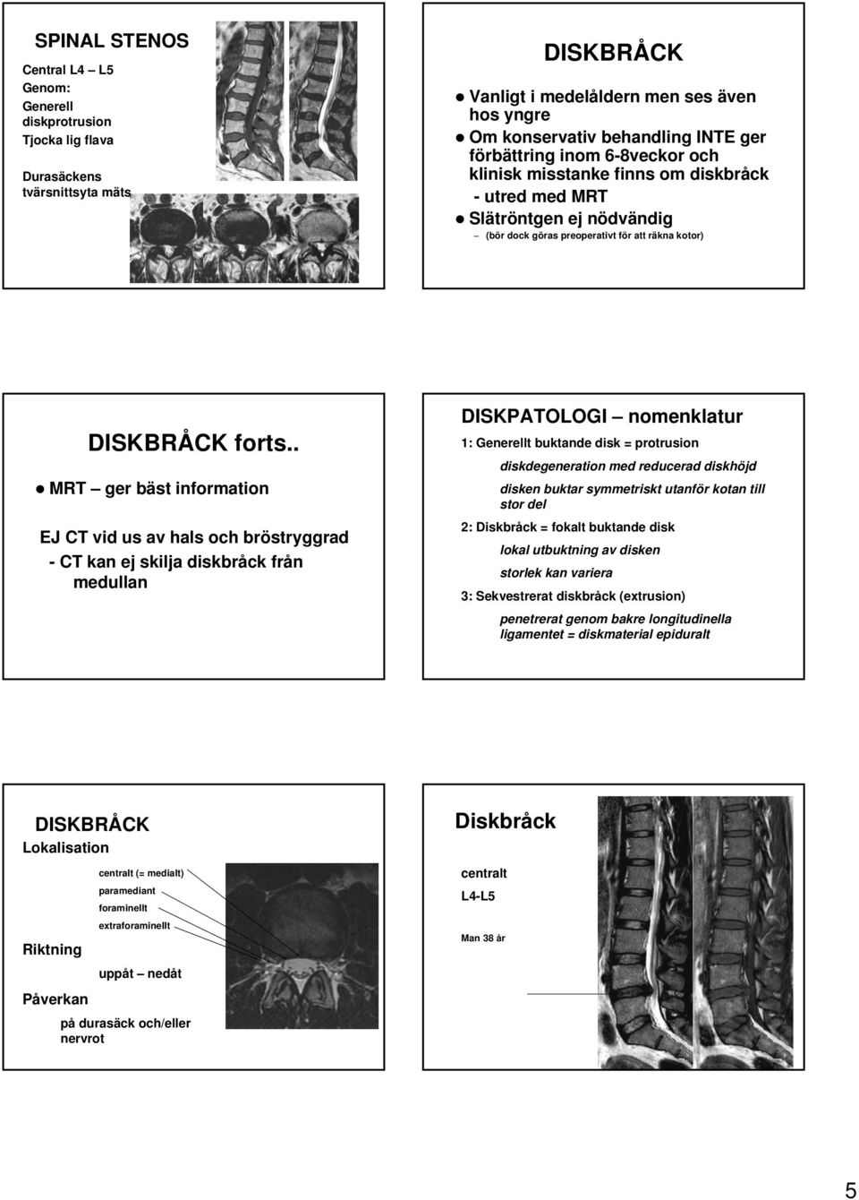 . MRT ger bäst information EJ CT vid us av hals och bröstryggrad - CT kan ej skilja diskbråck från medullan DISKPATOLOGI nomenklatur 1: Generellt buktande disk = protrusion diskdegeneration med