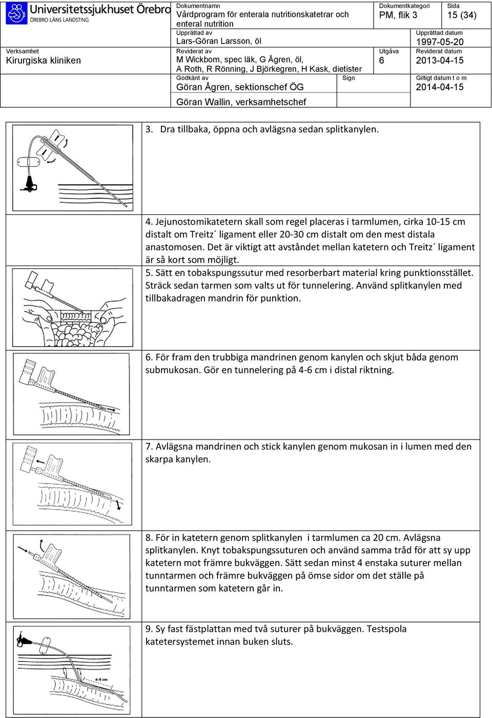 Det är viktigt att avståndet mellan katetern och Treitz ligament är så kort som möjligt. 5. Sätt en tobakspungssutur med resorberbart material kring punktionsstället.