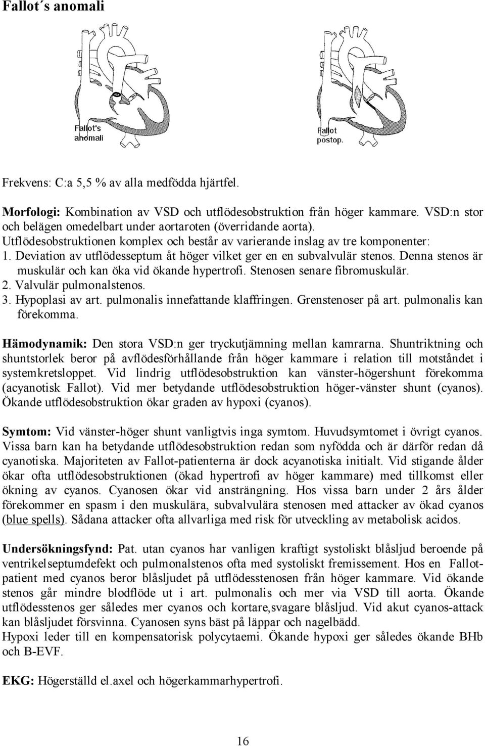 Deviation av utflödesseptum åt höger vilket ger en en subvalvulär stenos. Denna stenos är muskulär och kan öka vid ökande hypertrofi. Stenosen senare fibromuskulär. 2. Valvulär pulmonalstenos. 3.