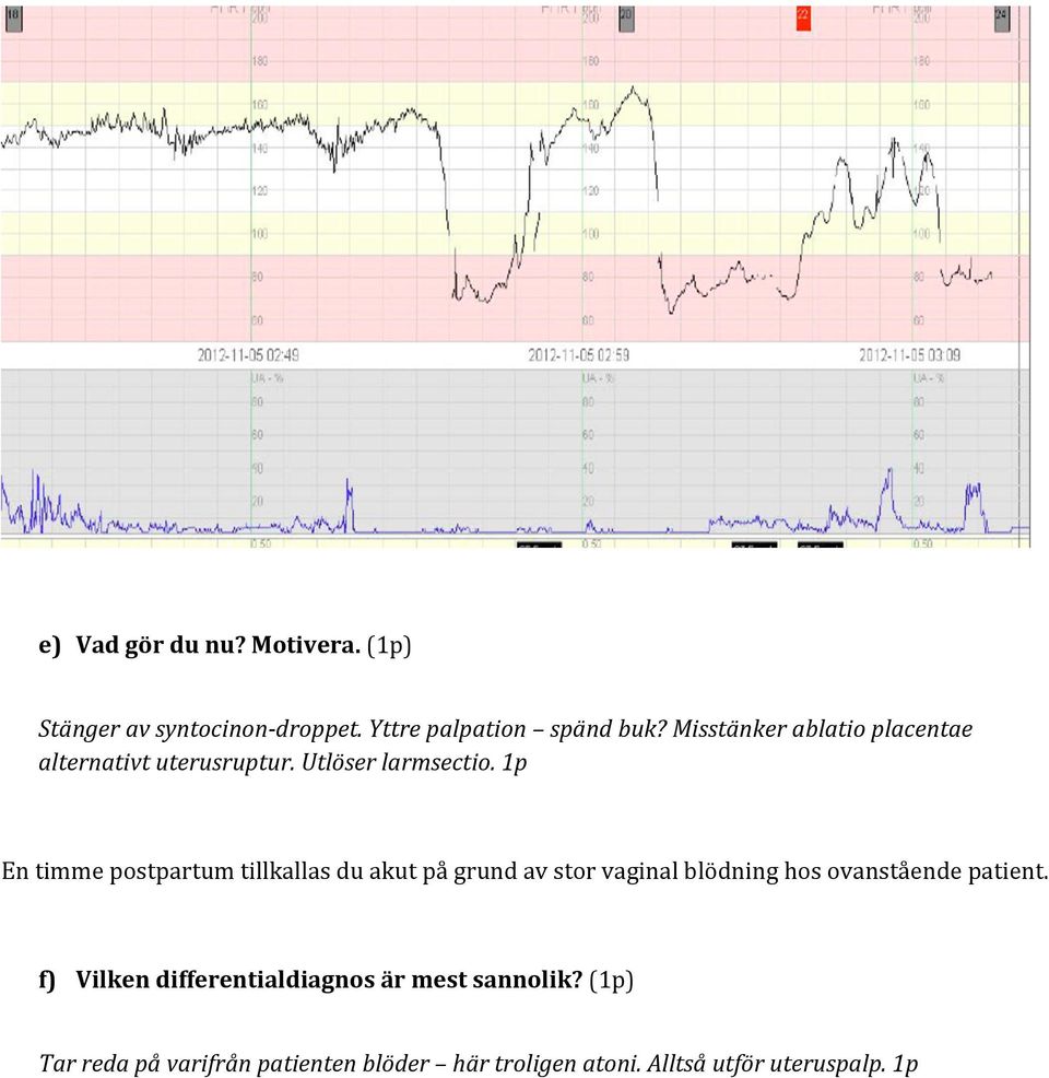 1p En timme postpartum tillkallas du akut på grund av stor vaginal blödning hos ovanstående patient.