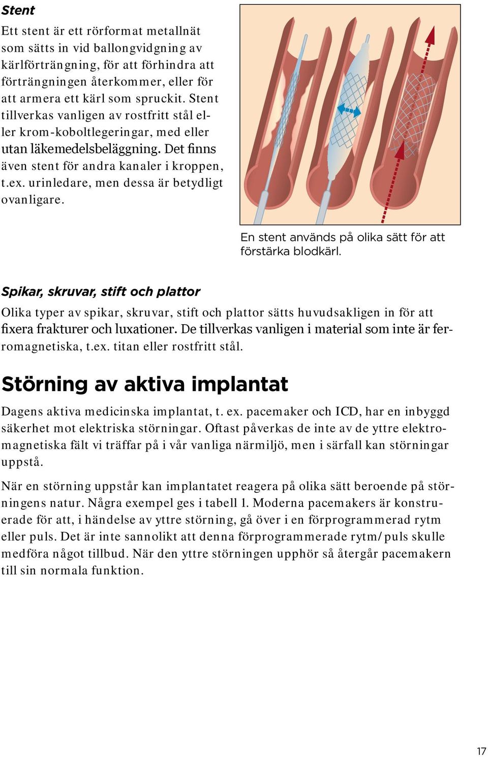 urinledare, men dessa är betydligt ovanligare. En stent används på olika sätt för att förstärka blodkärl.