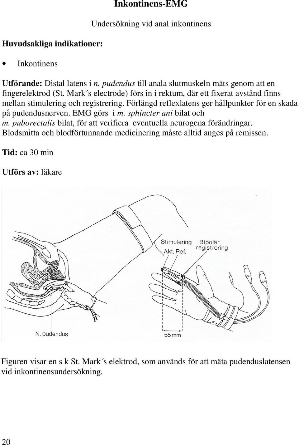 Förlängd reflexlatens ger hållpunkter för en skada på pudendusnerven. EMG görs i m. sphincter ani bilat och m.