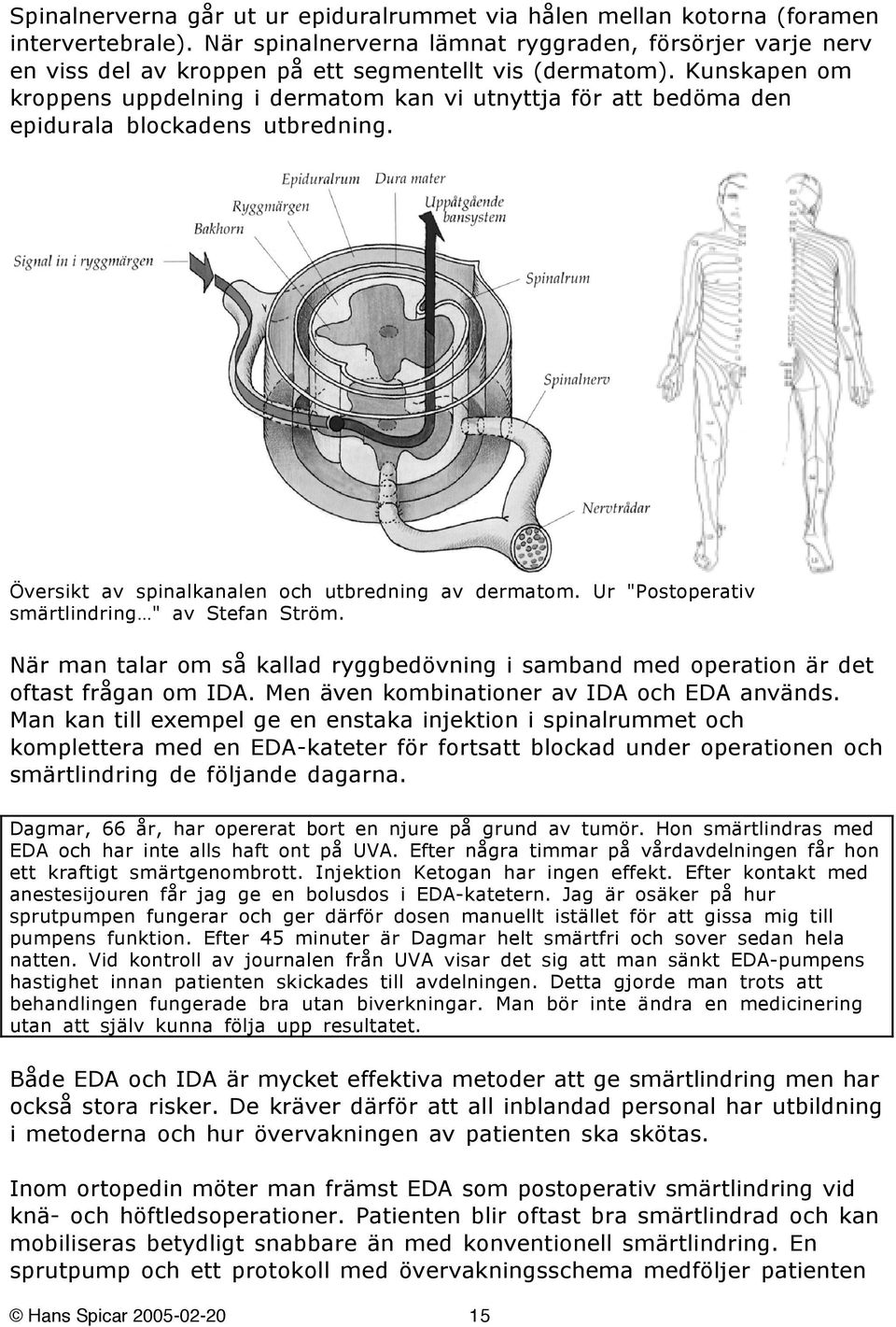 Kunskapen om kroppens uppdelning i dermatom kan vi utnyttja för att bedöma den epidurala blockadens utbredning. Översikt av spinalkanalen och utbredning av dermatom.