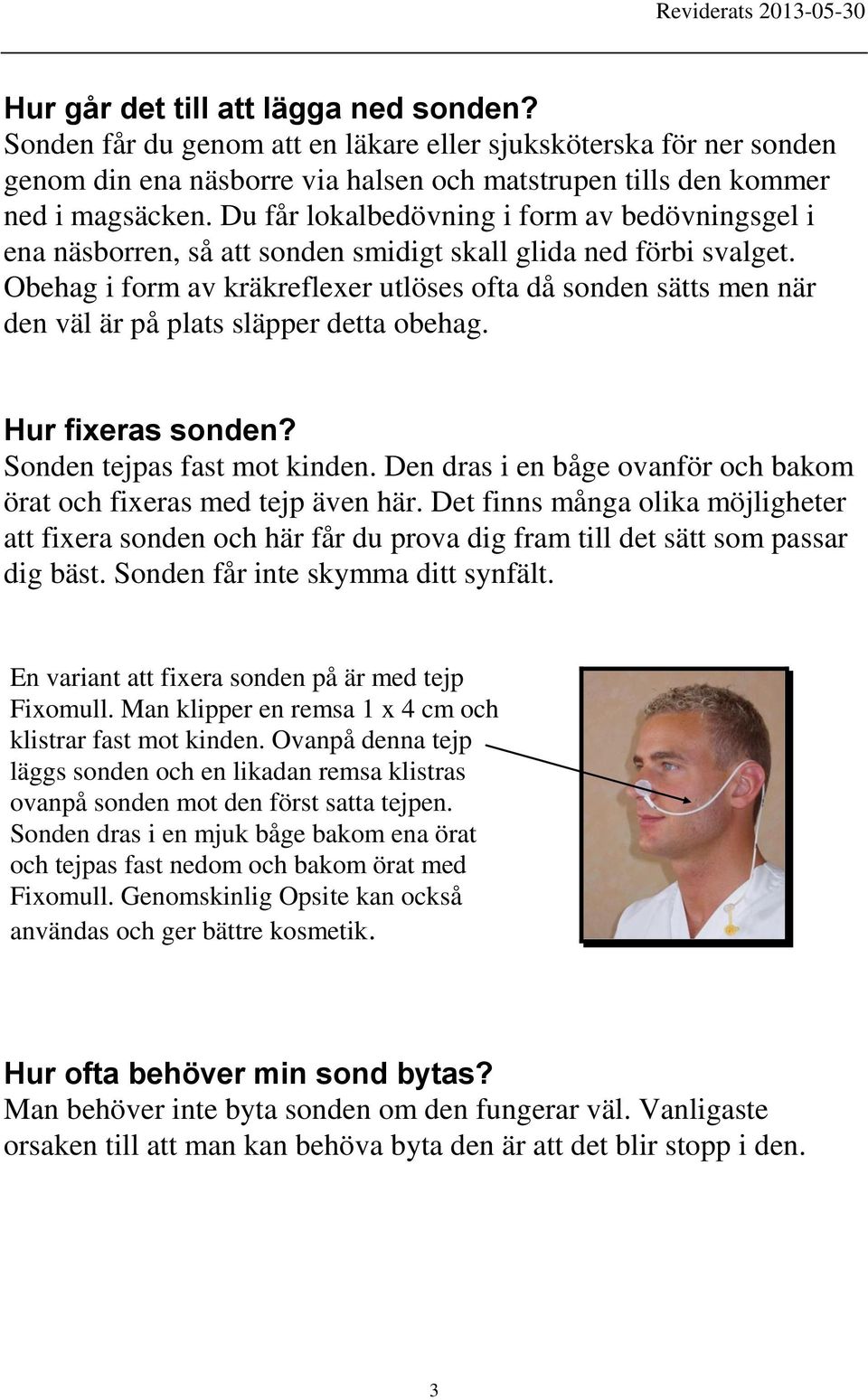 Obehag i form av kräkreflexer utlöses ofta då sonden sätts men när den väl är på plats släpper detta obehag. Hur fixeras sonden? Sonden tejpas fast mot kinden.