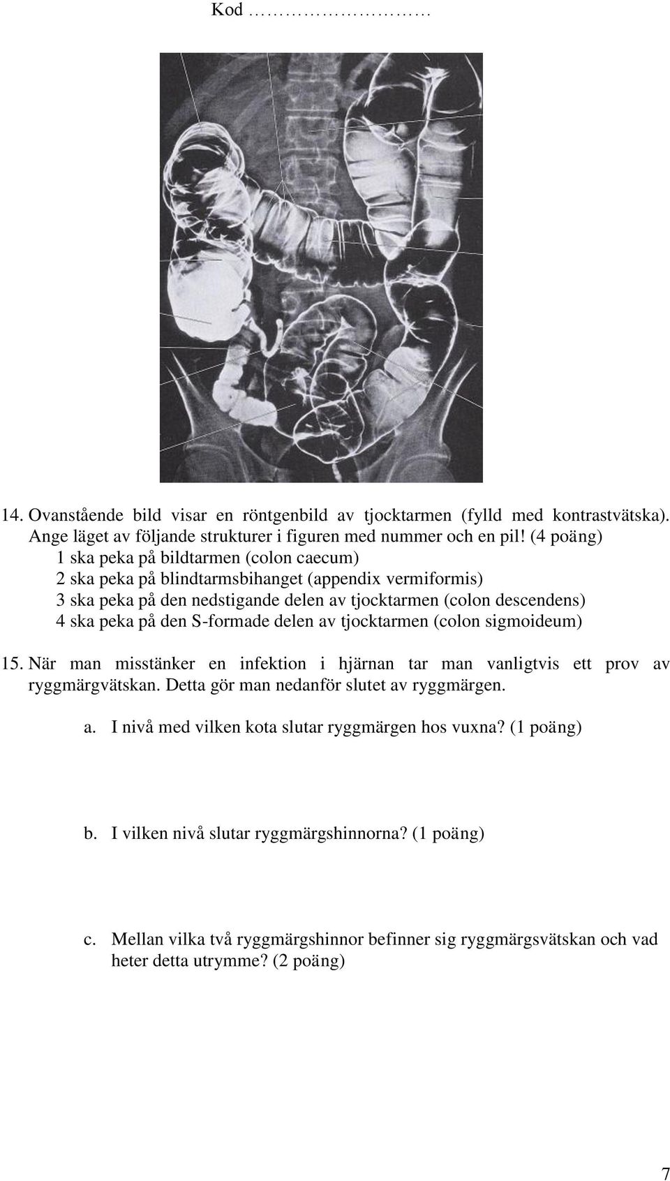 den S-formade delen av tjocktarmen (colon sigmoideum) 15. När man misstänker en infektion i hjärnan tar man vanligtvis ett prov av ryggmärgvätskan.