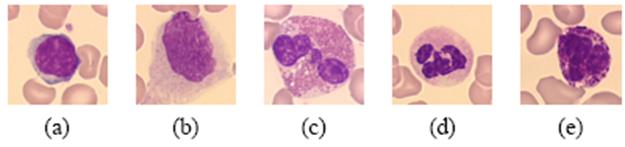att bestämma celltyp Examples of leukocyte color images: (a)