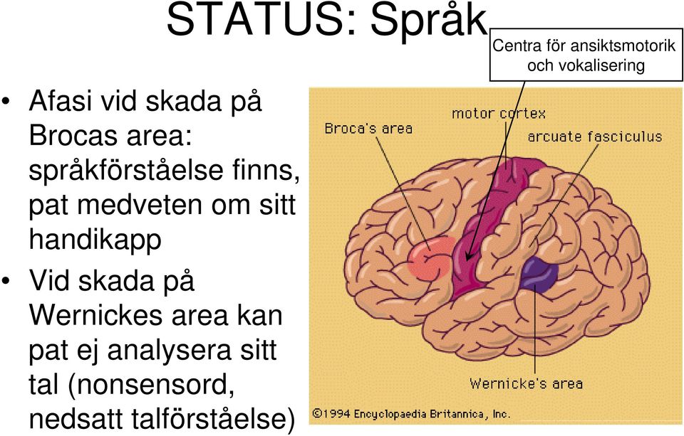 pat ej analysera sitt tal (nonsensord, nedsatt