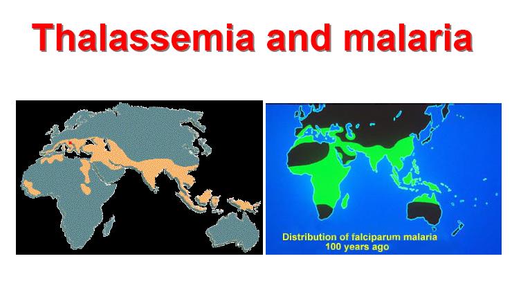 β- thalassemi