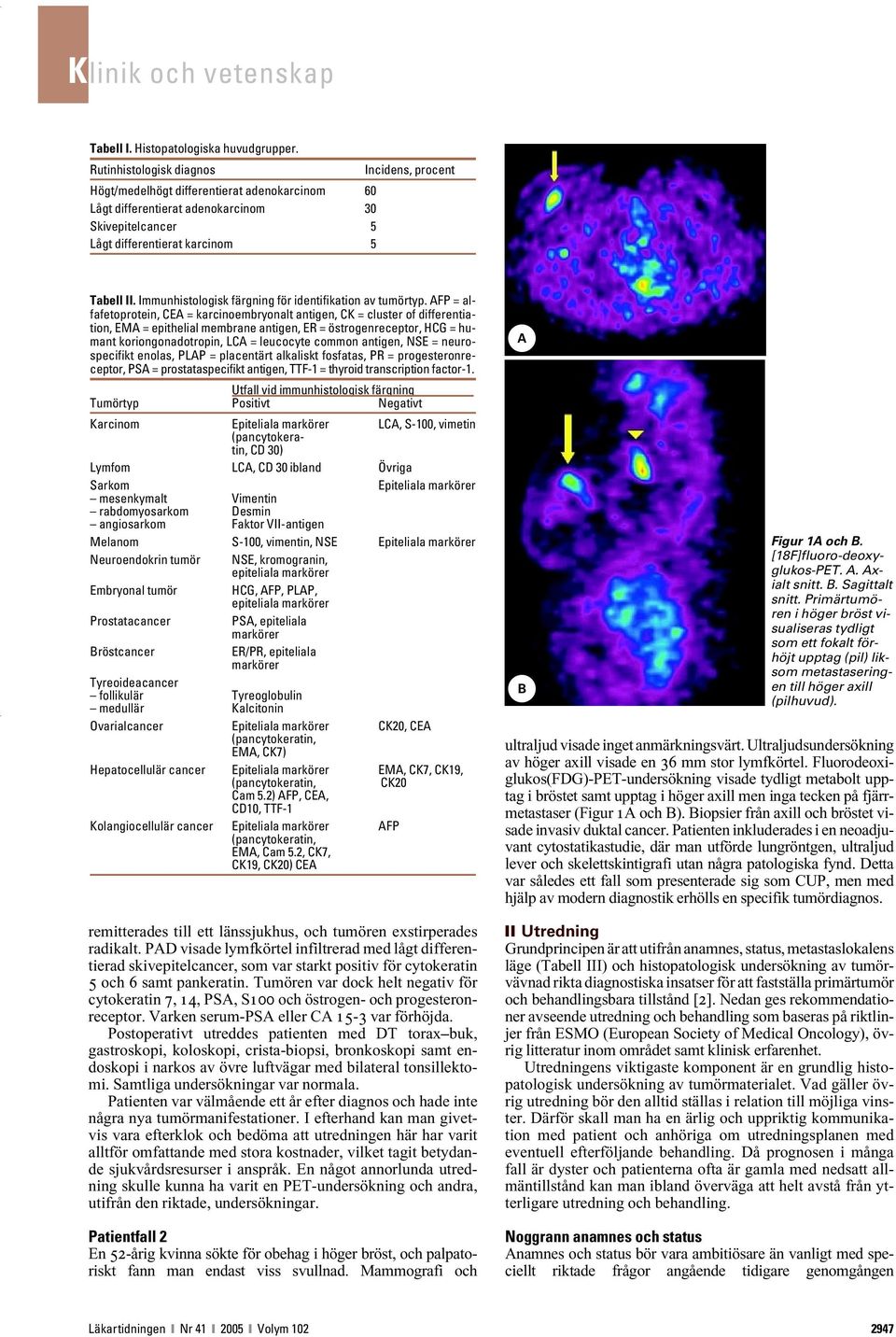 Immunhistologisk färgning för identifikation av tumörtyp.