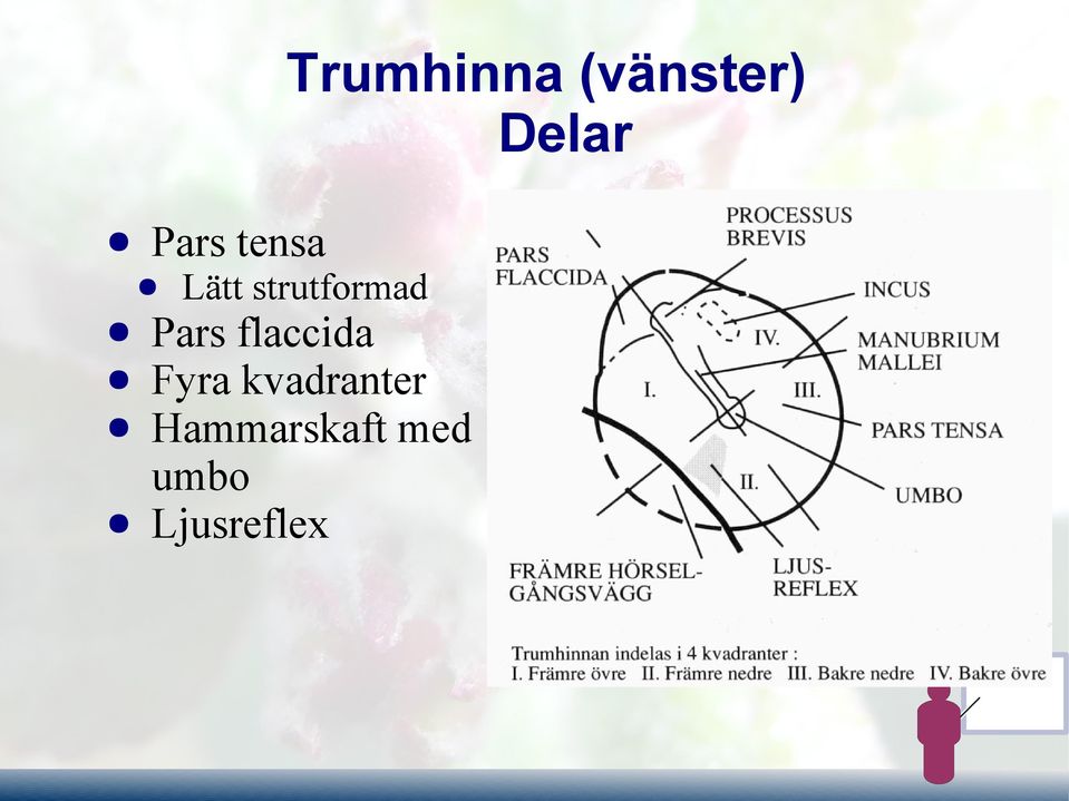 Pars flaccida Fyra