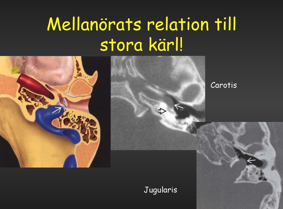 stora kärl!