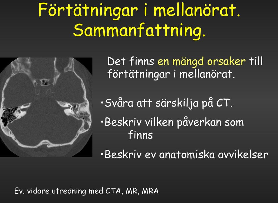 Svåra att särskilja på CT.