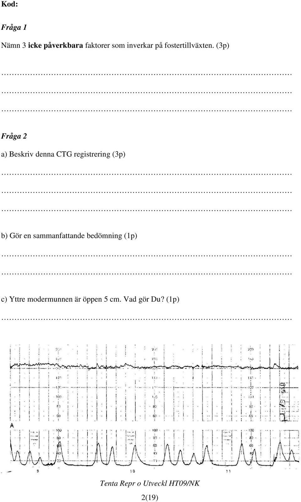 (3p) Fråga 2 a) Beskriv denna CTG registrering (3p) b)