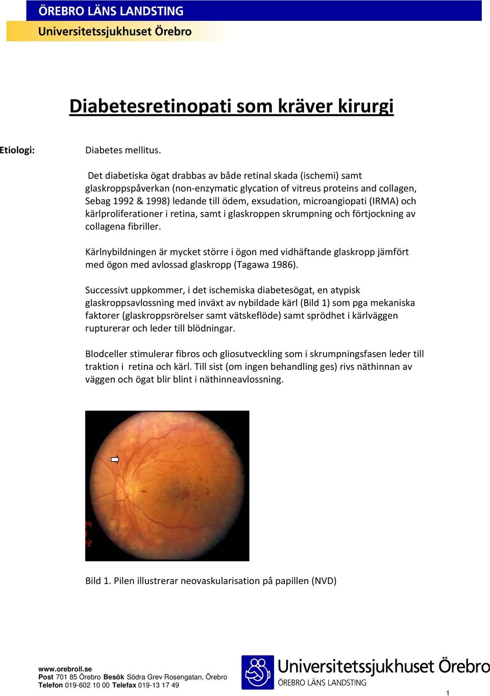 microangiopati (IRMA) och kärlproliferationer i retina, samt i glaskroppen skrumpning och förtjockning av collagena fibriller.