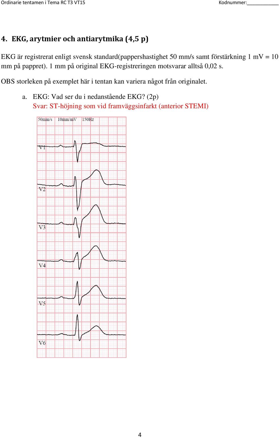 1 mm på original EKG-registreringen motsvarar alltså 0,02 s.