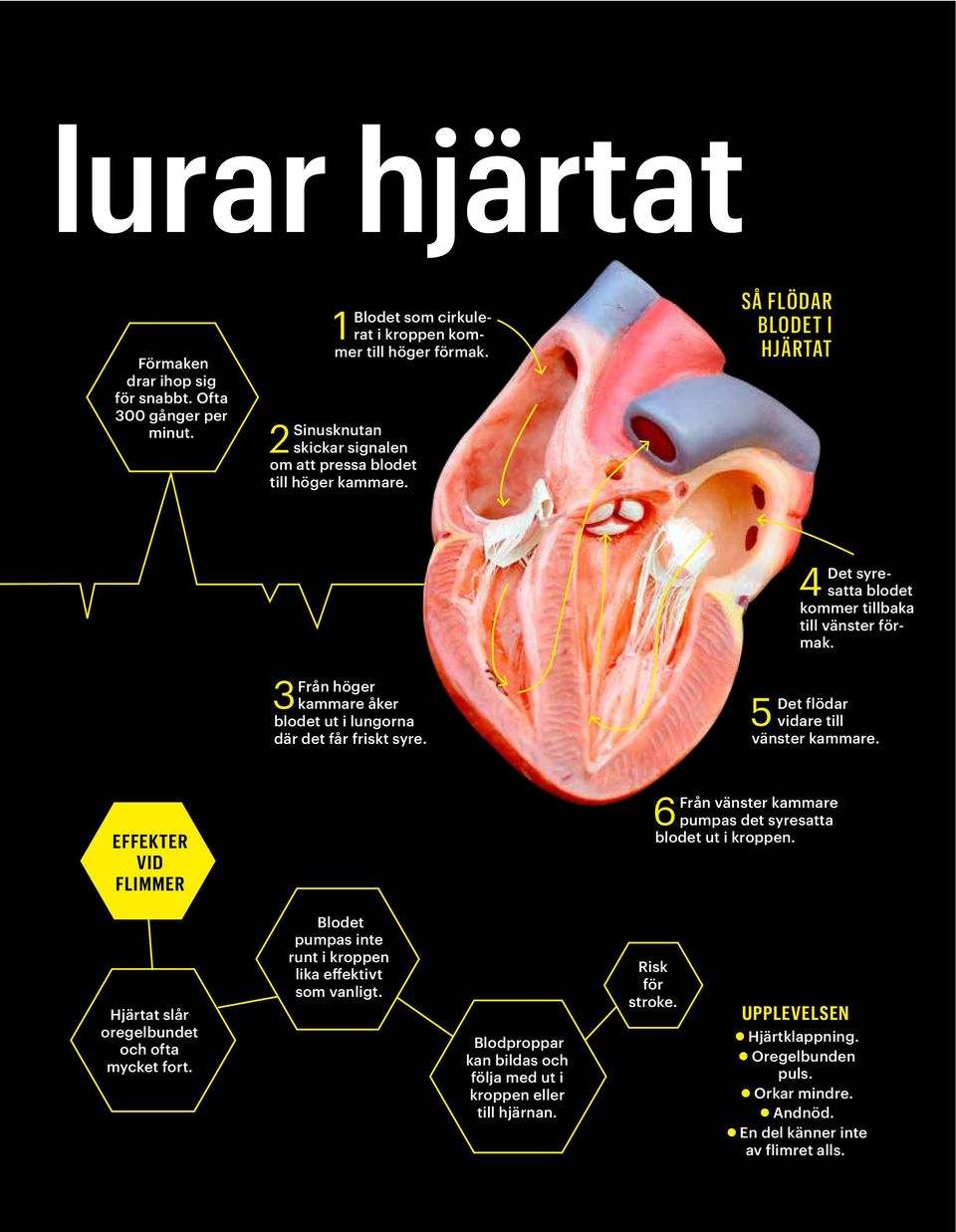 5 4 Det syresatta blodet kommer tillbaka till vänster förmak. Det flödar vidare till vänster kammare. EFFEKTER VID FLIMMER 6 Från vänster kammare pumpas det syresatta blodet ut i kroppen.