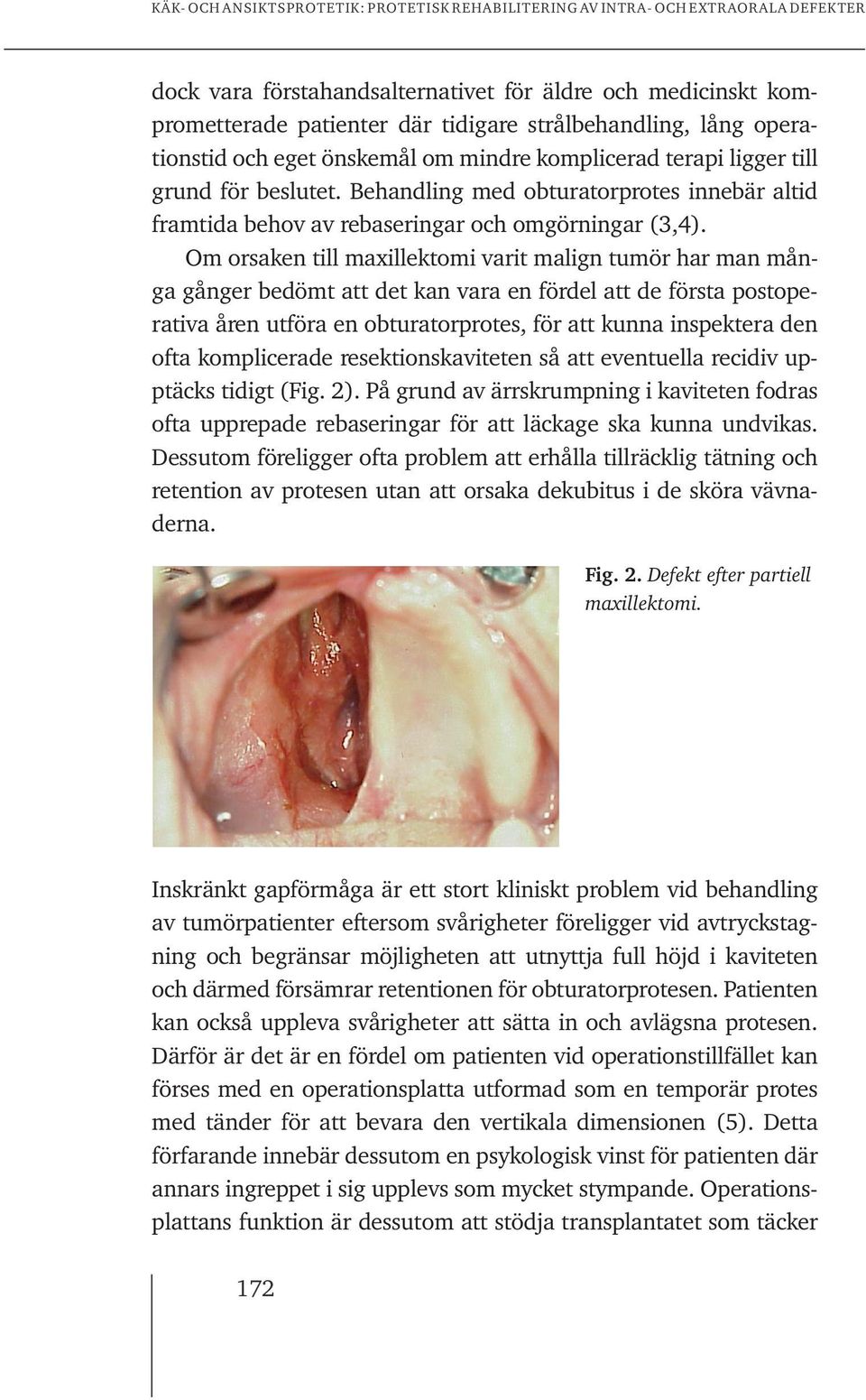 Om orsaken till maxillektomi varit malign tumör har man många gånger bedömt att det kan vara en fördel att de första postoperativa åren utföra en obturatorprotes, för att kunna inspektera den ofta