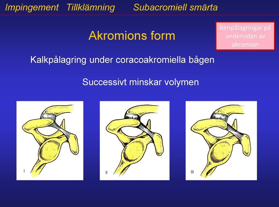 coracoakromiella bågen Successivt minskar