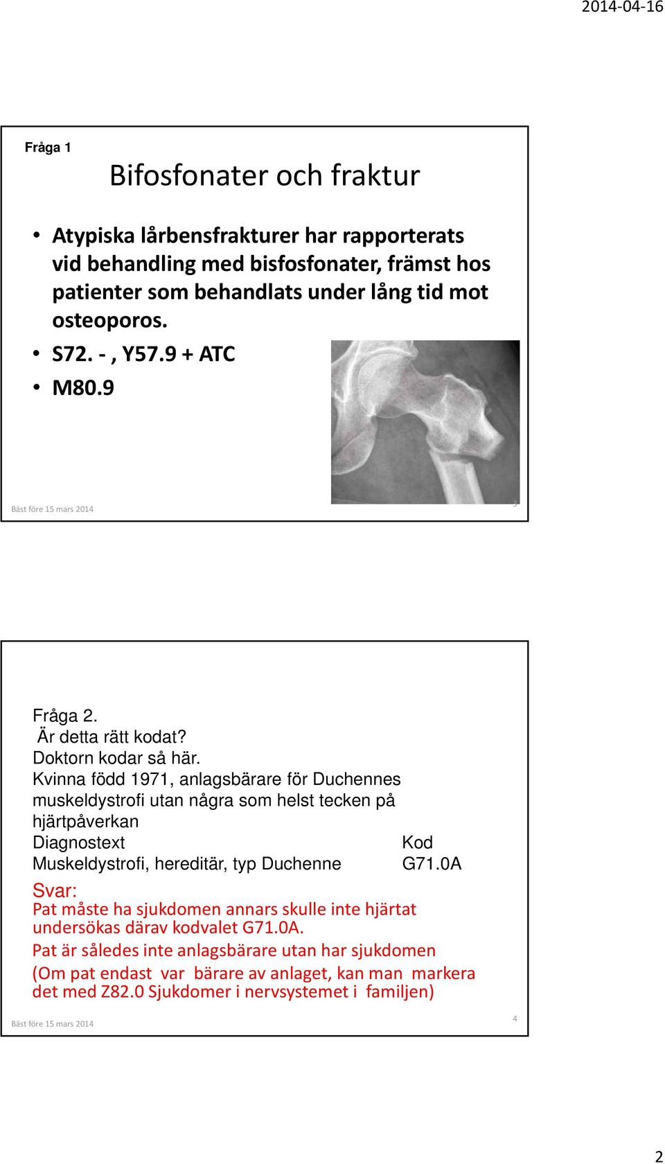 Kvinna född 1971, anlagsbärare för Duchennes muskeldystrofi utan några som helst tecken på hjärtpåverkan Diagnostext Kod Muskeldystrofi, hereditär, typ Duchenne G71.