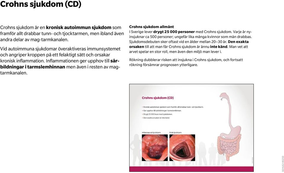 Inflammationen ger upphov till sårbildningar i tarmslemhinnan men även i resten av magtarmkanalen. Crohns sjukdom allmänt I Sverige lever drygt 25 000 personer med Crohns sjukdom.