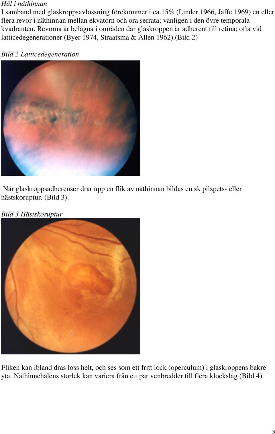 Revorna är belägna i områden där glaskroppen är adherent till retina; ofta vid latticedegenerationer (Byer 1974, Straatsma & Allen 1962).