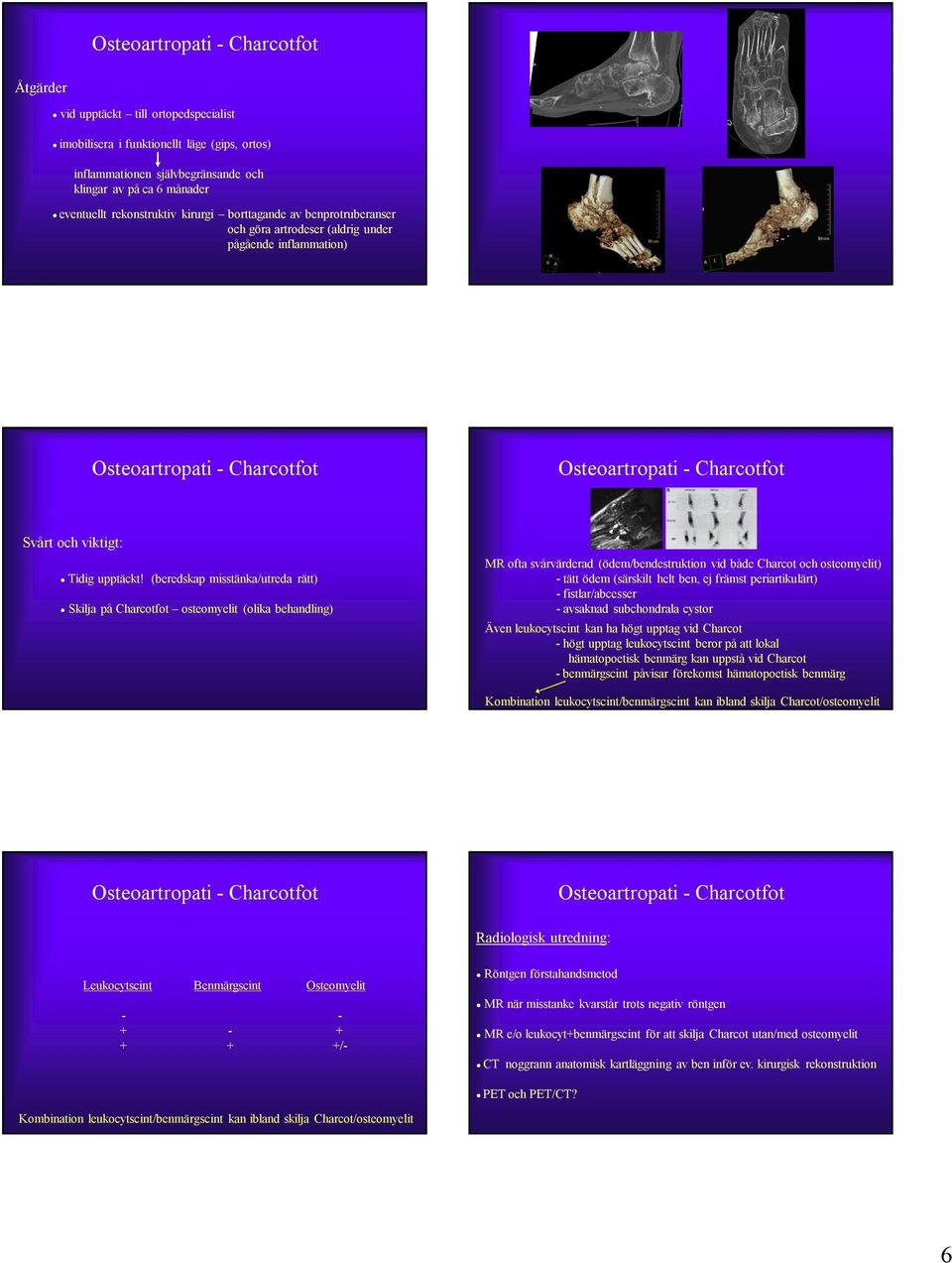 (beredskap misstänka/utreda rätt) Skilja på Charcotfot osteomyelit (olika behandling) MR ofta svårvärderad (ödem/bendestruktion vid både Charcot och osteomyelit) - tätt ödem (särskilt helt ben, ej