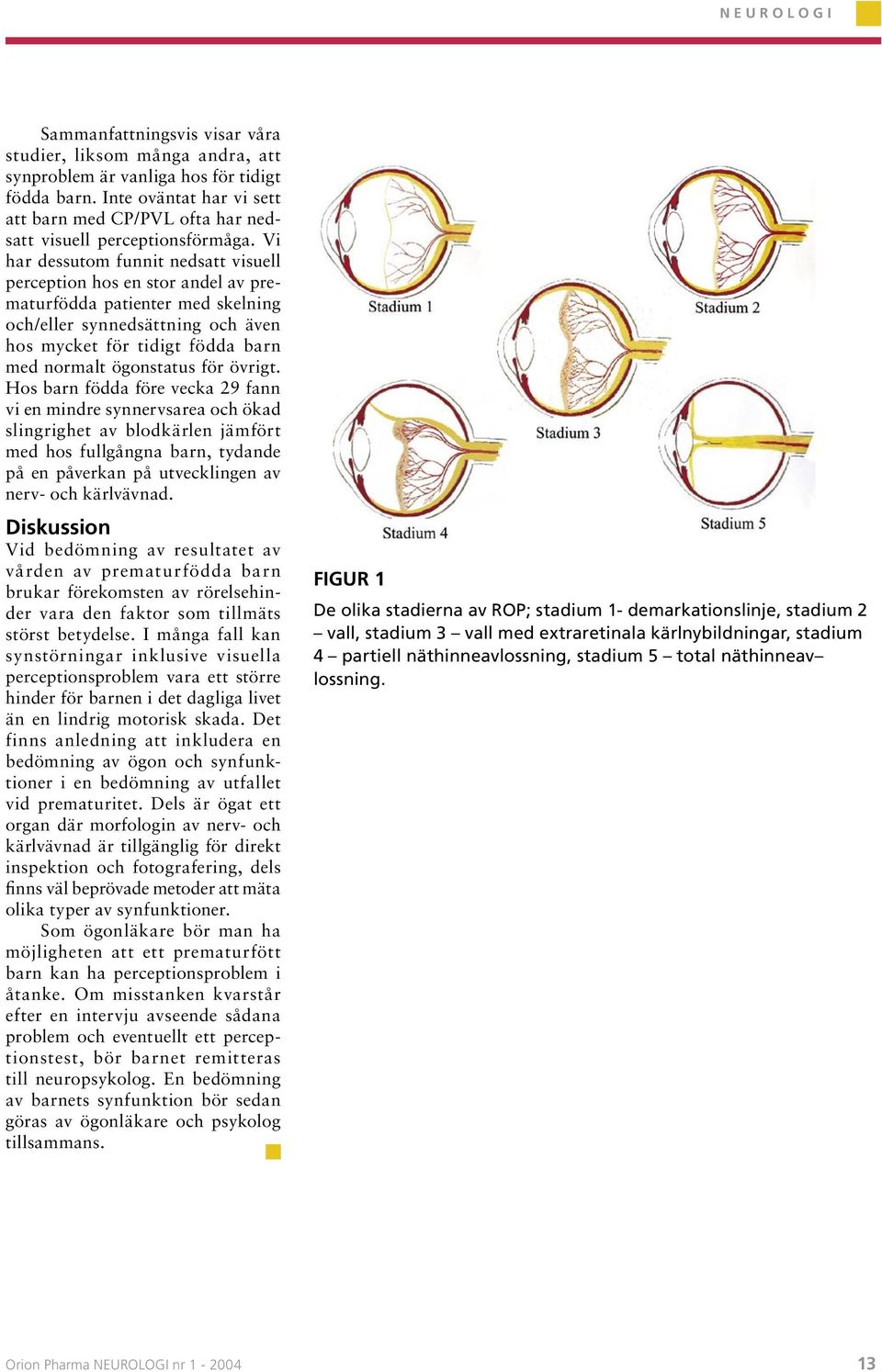 Vi har dessutom funnit nedsatt visuell perception hos en stor andel av prematurfödda patienter med skelning och/eller synnedsättning och även hos mycket för tidigt födda barn med normalt ögonstatus