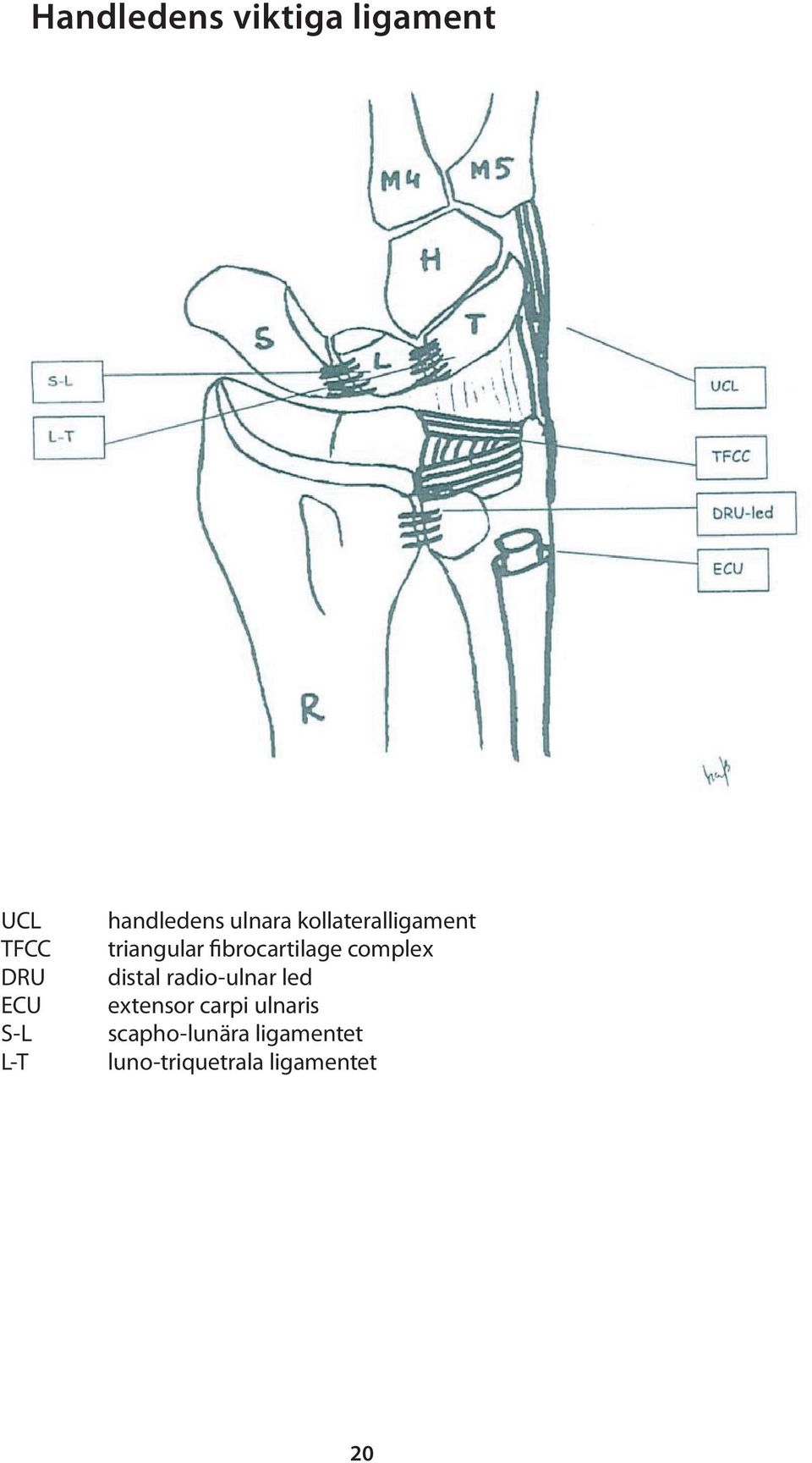 fibrocartilage complex distal radio-ulnar led extensor