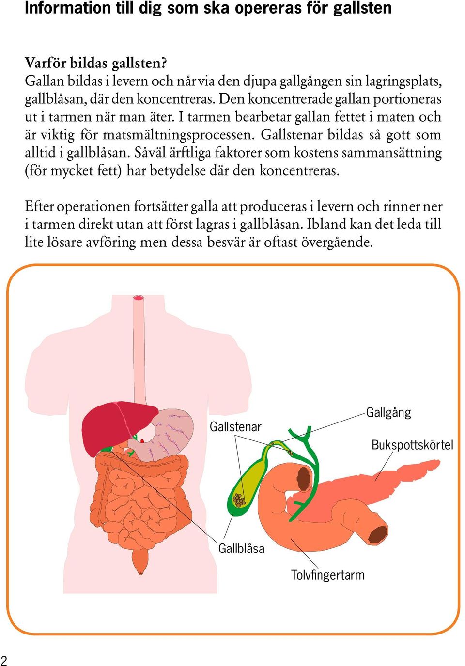 Gallstenar bildas så gott som alltid i gallblåsan. Såväl ärftliga faktorer som kostens sammansättning (för mycket fett) har betydelse där den koncentreras.