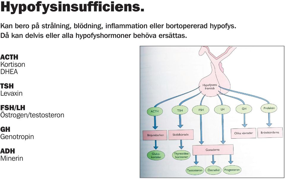 bortopererad hypofys.