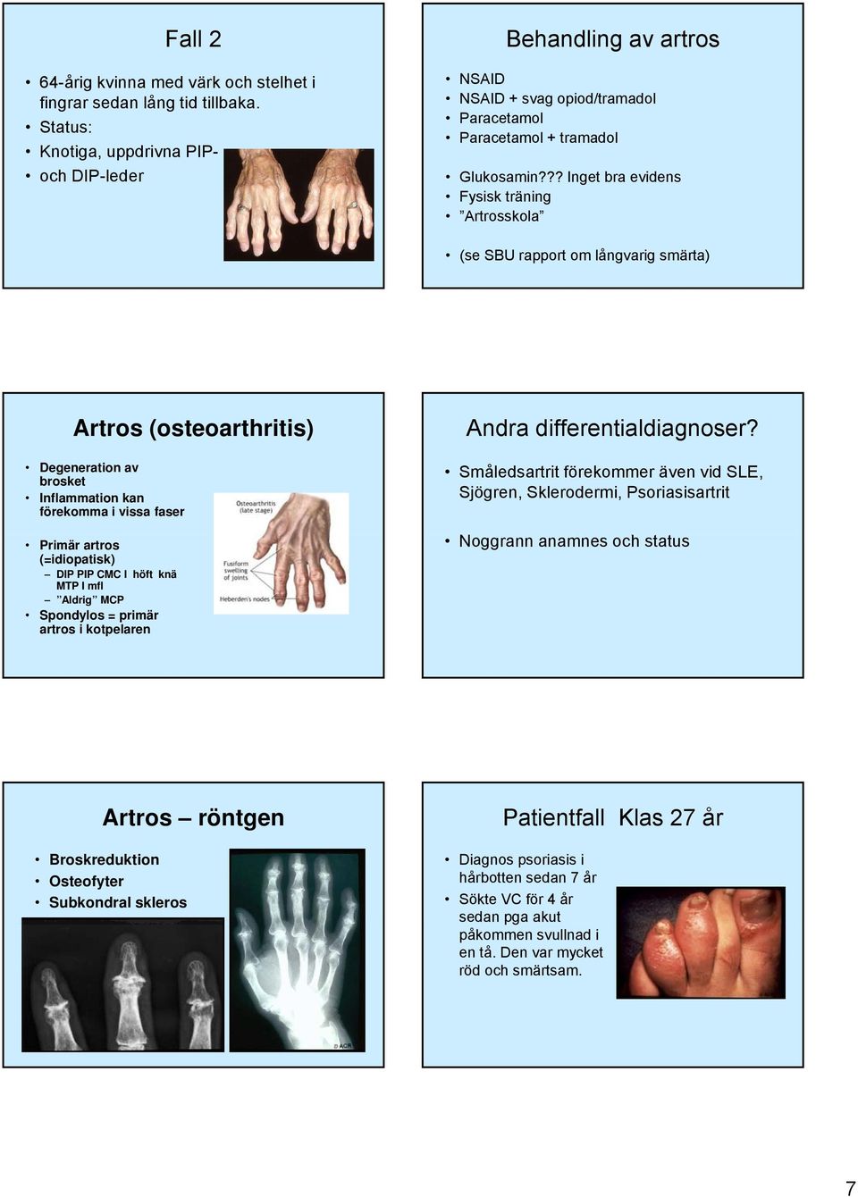 ?? Inget bra evidens Fysisk träning Artrosskola (se SBU rapport om långvarig smärta) Artros (osteoarthritis) Degeneration av brosket Inflammation kan förekomma i vissa faser Primär artros