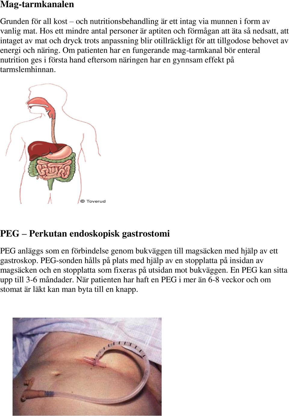 Om patienten har en fungerande mag-tarmkanal bör enteral nutrition ges i första hand eftersom näringen har en gynnsam effekt på tarmslemhinnan.