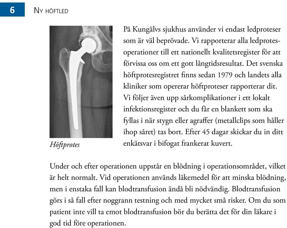 Det svenska höftprotesregistret finns sedan 1979 och landets alla kliniker som opererar höftproteser rapporterar dit.