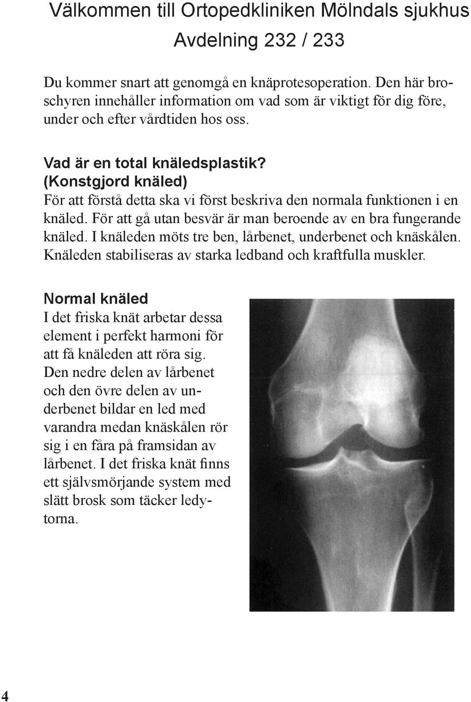 (Konstgjord knäled) För att förstå detta ska vi först beskriva den normala funktionen i en knäled. För att gå utan besvär är man beroende av en bra fungerande knäled.