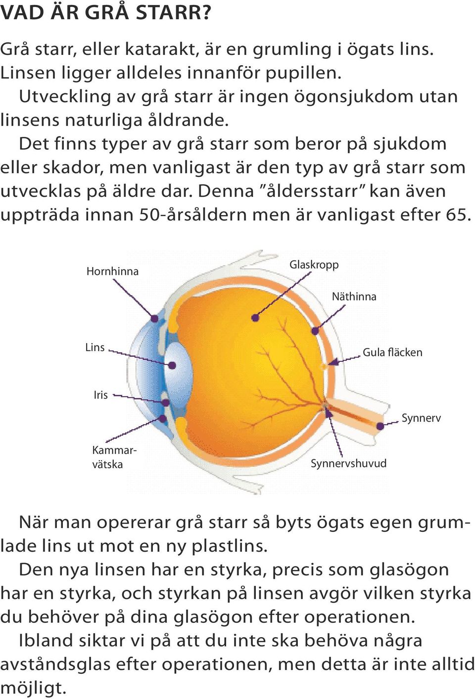 Denna åldersstarr kan även uppträda innan 50-årsåldern men är vanligast efter 65.