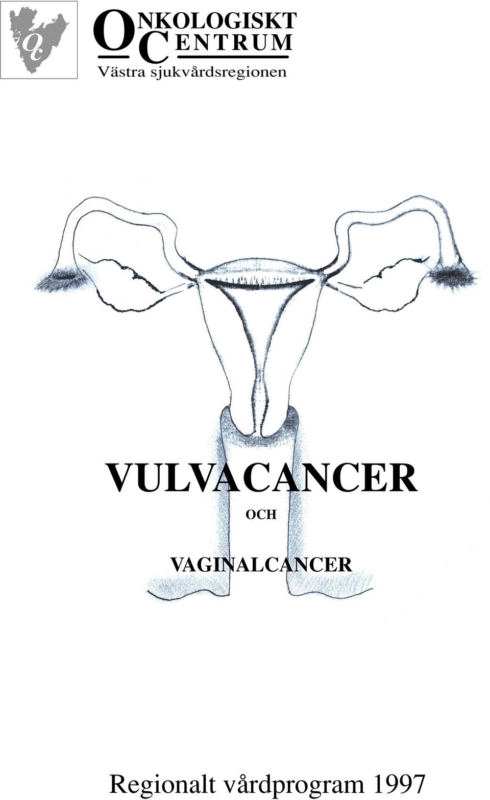 VULVACANCER OCH