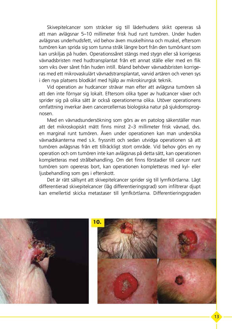 Operationssåret stängs med stygn eller så korrigeras vävnadsbristen med hudtransplantat från ett annat ställe eller med en flik som viks över såret från huden intill.