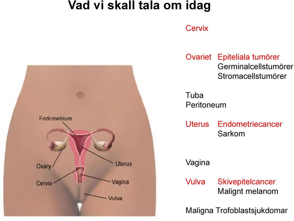 Peritoneum Uterus Endometriecancer Sarkom Vagina Vulva