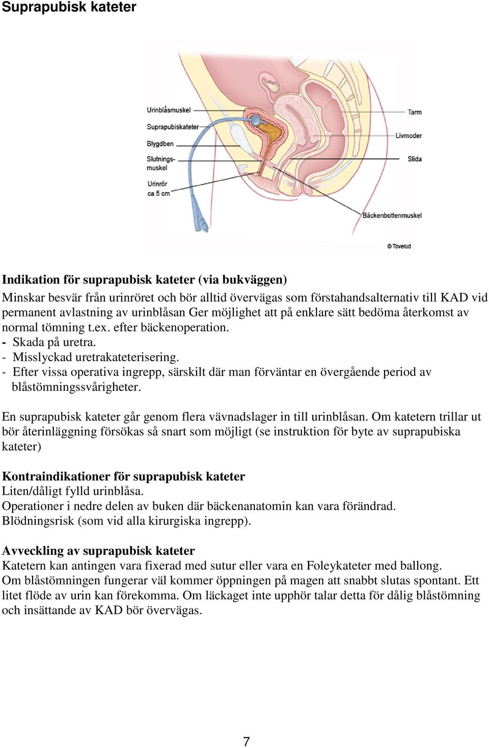 - Efter vissa operativa ingrepp, särskilt där man förväntar en övergående period av blåstömningssvårigheter. En suprapubisk kateter går genom flera vävnadslager in till urinblåsan.