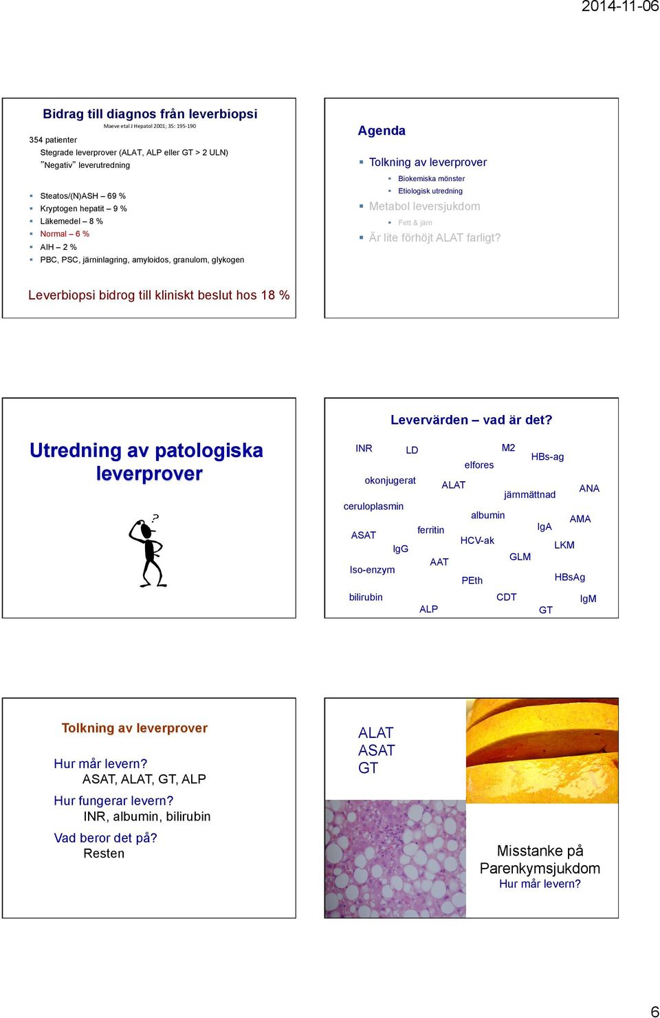 Fett & järn! Är lite förhöjt ALAT farligt? Leverbiopsi bidrog till kliniskt beslut hos 8 % 3 3 Levervärden vad är det?