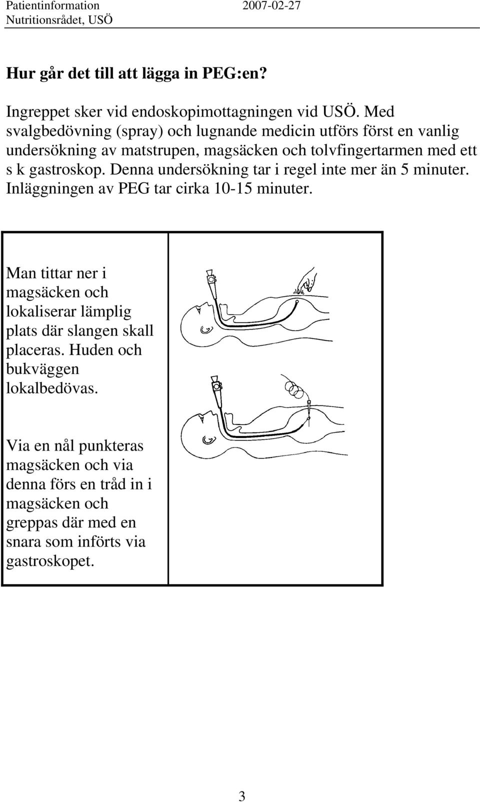 gastroskop. Denna undersökning tar i regel inte mer än 5 minuter. Inläggningen av PEG tar cirka 10-15 minuter.