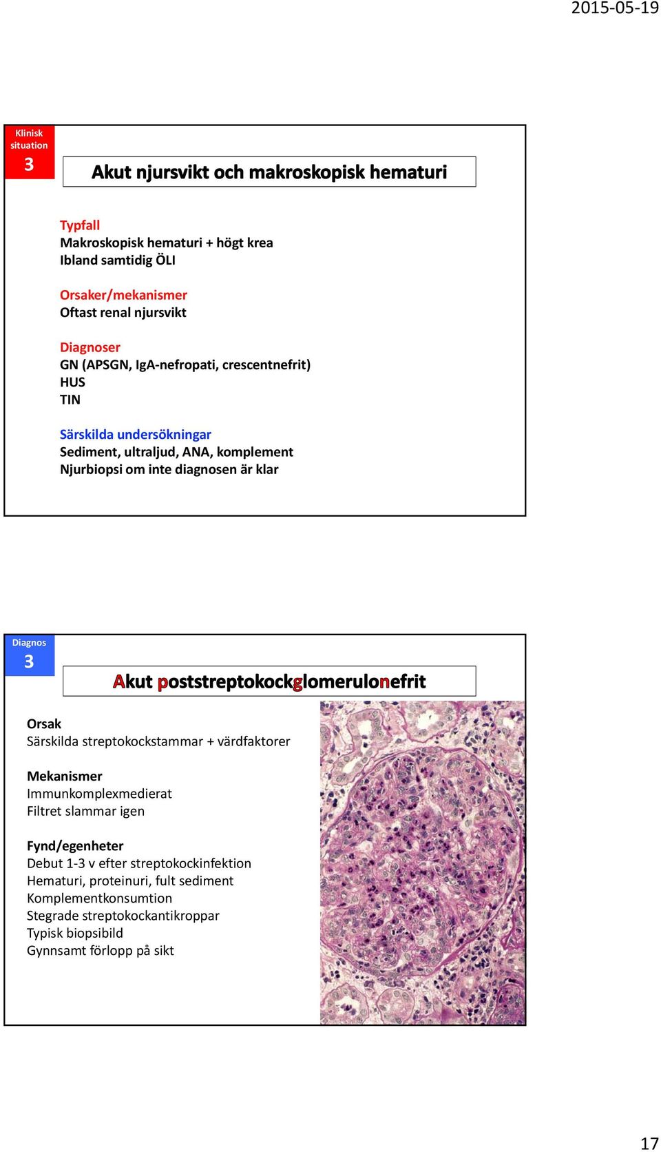 3 Orsak Särskilda streptokockstammar + värdfaktorer Mekanismer Immunkomplexmedierat Filtret slammar igen Fynd/egenheter Debut 1 3 v efter