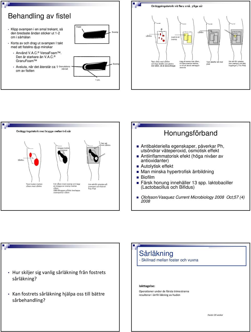 Honungsförband Antibakteriella egenskaper, påverkar Ph, utsöndrar väteperoxid, osmotisk effekt Antiinflammatorisk efekt (höga nivåer av antioxidanter) Autolytisk effekt Man minska hypertrofisk