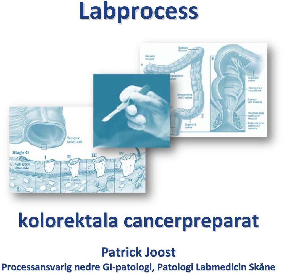 Processansvarig nedre GI